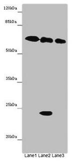 TOX3 Antibody in Western Blot (WB)