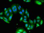 USP6 Antibody in Immunocytochemistry (ICC/IF)