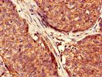 USP6 Antibody in Immunohistochemistry (Paraffin) (IHC (P))