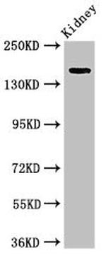 USP6 Antibody in Western Blot (WB)