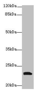 YKT6 Antibody in Western Blot (WB)