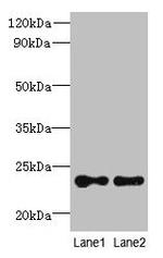 TMED2 Antibody in Western Blot (WB)