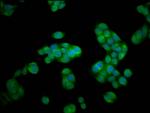 HEXA Antibody in Immunocytochemistry (ICC/IF)