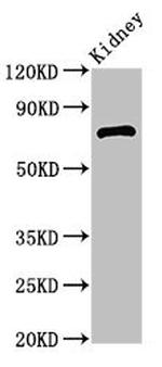 ZBTB16 Antibody in Western Blot (WB)