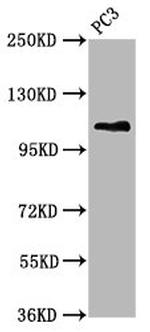 MTMR15 Antibody in Western Blot (WB)