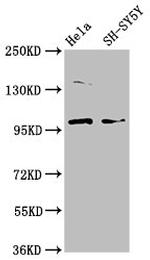 PDE6C Antibody in Western Blot (WB)