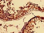 RBMY1A1 Antibody in Immunohistochemistry (Paraffin) (IHC (P))