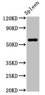 RBMY1A1 Antibody in Western Blot (WB)