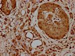 HSPA1A Antibody in Immunohistochemistry (Paraffin) (IHC (P))