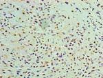 GALE Antibody in Immunohistochemistry (Paraffin) (IHC (P))