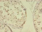 RBMY1F Antibody in Immunohistochemistry (Paraffin) (IHC (P))