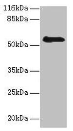 RBMY1F Antibody in Western Blot (WB)