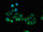 RCAN2 Antibody in Immunocytochemistry (ICC/IF)