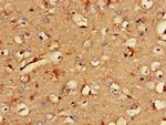 RCAN2 Antibody in Immunohistochemistry (Paraffin) (IHC (P))