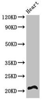 RCAN2 Antibody in Western Blot (WB)