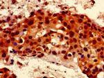 RALBP1 Antibody in Immunohistochemistry (Paraffin) (IHC (P))