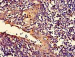 RALBP1 Antibody in Immunohistochemistry (Paraffin) (IHC (P))