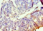 PAK2 Antibody in Immunohistochemistry (Paraffin) (IHC (P))