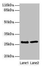 EBP Antibody in Western Blot (WB)