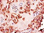 NAALADL2 Antibody in Immunohistochemistry (Paraffin) (IHC (P))