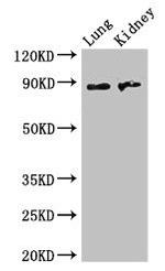 NAALADL2 Antibody in Western Blot (WB)