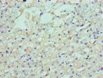 LDLRAP1 Antibody in Immunohistochemistry (Paraffin) (IHC (P))