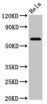 SLC22A25 Antibody in Western Blot (WB)