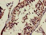 CHST9 Antibody in Immunohistochemistry (Paraffin) (IHC (P))