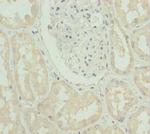 SLC39A4 Antibody in Immunohistochemistry (Paraffin) (IHC (P))