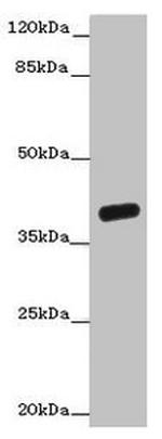 OGFOD2 Antibody in Western Blot (WB)