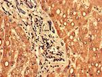 PPP1R3B Antibody in Immunohistochemistry (Paraffin) (IHC (P))