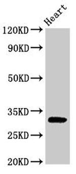 PPP1R3B Antibody in Western Blot (WB)