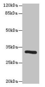 PPP1R3B Antibody in Western Blot (WB)