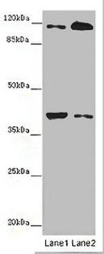 Allergin 1 Antibody in Western Blot (WB)