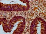 THNSL2 Antibody in Immunohistochemistry (Paraffin) (IHC (P))