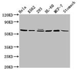 GATAD2A Antibody in Western Blot (WB)