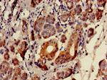 SULF2 Antibody in Immunohistochemistry (Paraffin) (IHC (P))