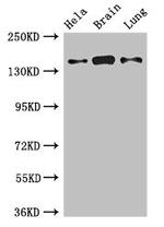 SULF2 Antibody in Western Blot (WB)