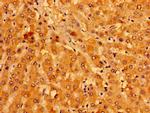 MCAT Antibody in Immunohistochemistry (Paraffin) (IHC (P))