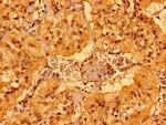 MCAT Antibody in Immunohistochemistry (Paraffin) (IHC (P))