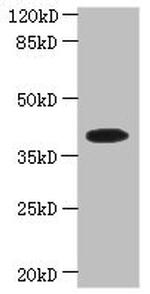 PSTK Antibody in Western Blot (WB)