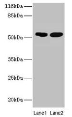 SVOPL Antibody in Western Blot (WB)