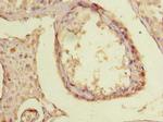 TTC30B Antibody in Immunohistochemistry (Paraffin) (IHC (P))