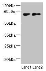 TTC30B Antibody in Western Blot (WB)