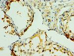 NLGN4Y Antibody in Immunohistochemistry (Paraffin) (IHC (P))