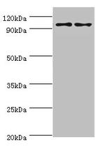 NLGN4Y Antibody in Western Blot (WB)