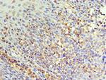 IL-22 Receptor alpha Antibody in Immunohistochemistry (Paraffin) (IHC (P))