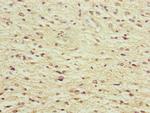 NEDD1 Antibody in Immunohistochemistry (Paraffin) (IHC (P))