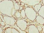 NEDD1 Antibody in Immunohistochemistry (Paraffin) (IHC (P))