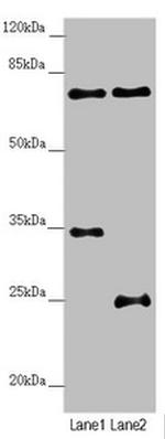 NEDD1 Antibody in Western Blot (WB)